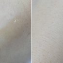 헤어시에프(CF)