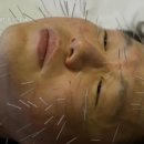 천호퍼스트한의원 이미지