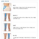 테이핑 방법 - 스포츠 밸란스 탄력 테이핑 방법 이미지