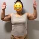 (주)사세 | 수원 빅사이즈 팔뚝지방추출 찐후기 3달만에 10kg 감량할 수 있던 비결은