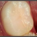 서울큰사랑치과의원 이미지