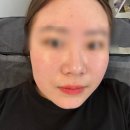 울산 북구 피부관리 꼼꼼한 케어로 만족한 올가드림뷰티 호계점