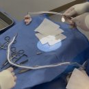 강구외과의원 | [단기연재 4] AVF vs AVG 무엇이 더 좋을까? 동정맥루 Creation 수술 후기