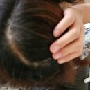 헤어플러스 | 두피탈모영양제 아나셀플러스 8% 헤어토닉 사용 후기