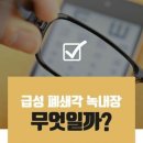 급성 폐쇄각 녹내장의 원인 이미지