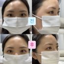 용마초등학교 | 중곡동속눈썹펌. [헤니움뷰티] 자연스러운 속눈썹펌 후기, 야간시술도 가능한 군자 속눈썹펌.