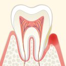 시큰~ 찌릿~ ‘민감성 치아’의 관리 이미지