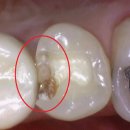 크라운치과의원 이미지