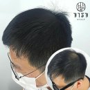 하이테크닉 이미지