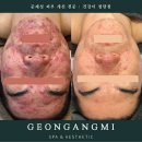 건강미 피부관리