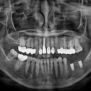 덴토피아치과의원 이미지