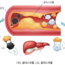 심장병,뇌졸중, 동맥경화증,고지혈증의 주범 콜레스테롤을 알고 관리하자. 이미지