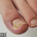 대전레푸스다솜네일 이미지