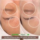 프레쉬브로우 이미지