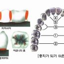 정DENTAL Daum카페
