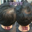 큐사랑헤어염색 이미지