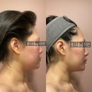 원스프롬X글라리안