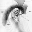 이명, 귀울음(신허성(腎虛性), 신경성(神經性), 간담화성(肝膽火性)), 이명이롱(耳鳴耳聾) 침구치료 이미지