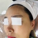 🧖‍♀️마곡피부관리‘희아로움’ 아로마테라피 + 수분관리 솔직후기🌿💧