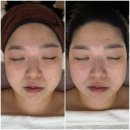 아르떼에스테틱 | 진천피부관리 잘하는 곳｜아르떼에스테틱 에스테틱 후기