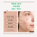동탄피부관리,동탄여드름케어, 동탄여드름압출)흉터 재생에는 약초필링 추천!!#퓨어스킨테라피
