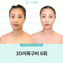 대구 피부관리 고운빛깔에스테틱 대구점 후기 | 30년 노하우가 이런 거구나!
