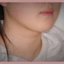 잠실의 교정전문가, 서울이오스치과에서 미소를 되찾아보세요! ✨