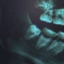 휴부부치과의원 이미지