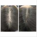 네일샵에스 아를솔즈 문제성발톱 발각질 네일