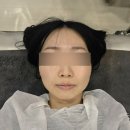 아리움헤어 | 창원피부관리 모공디톡스 받고 수부지에서 깐달걀 피부로ㅣ남양동 아리움