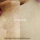 KGY-김가연뷰티케어