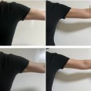 곡성-259 | 도약한의원#8 / 산삼라인샷 팔뚝 12회차, 허벅지 6회차 지방분해주사