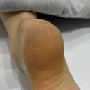 풋풋 | 중랑구 상봉발각질 풋풋한리쌤 상봉점 패디플래닝 후기