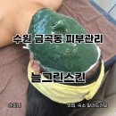 늘그린스킨