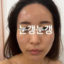 157-1-000099 | 대구 달성군 다사읍 피부관리샵 [솔루나 뷰티] 대구신부관리 후기₊˚ʚ₍ᐢ. ̫.ᐢ₎₊˚✧ ﾟ.