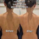 미사 웨딩관리 아르모드에스테틱 웨딩드레스라인관리 솔직후기