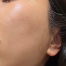 스킨리프 | 하남 피부관리 신규 오픈 천연팩 관리 리프온스킨 방문 후기 ✨