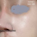 내돈내산후기 - 민감성피부쿠션추천 문샷 픽싱 쿠션,라라베시 악마쿠션