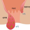 선항외과 이미지