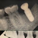 연세메이트의원 이미지