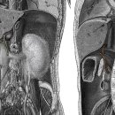 common bile duct(온쓸개관) 이미지