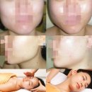 피부미인 관리실 이미지