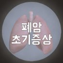 폐암 초기증상 놓치면 큰일나요 이미지