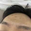 꼼에스테틱대전 | 꼼에스테틱 용문점, 대전 여드름 피부관리 후기