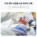 258_260621_infant mortality rate dropped in US 이미지