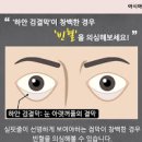 빈혈 원인 정상 빈혈수치 빈혈에 좋은 음식 두통 이미지