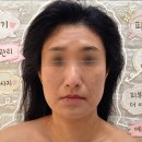 피부이야기 - 시흥시 신천동 | 수원피부관리 피부이야기, 거북목관리 목·어깨 후기