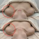 창원 중동 에스테틱 물오른피부 상체관리후기