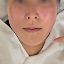 정자나무길~시청로 | [달달댕쥬 리뷰] 분당피부관리 추천, 스파나무 정자점 에너지 얼굴관리 후기