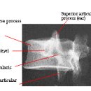 X- Ray 방사선 촬영법 이미지